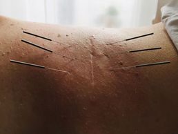 immagine di Nicole Signer - Praxis für Akupunktur & Tuina