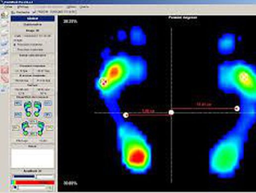 Bild zu CAP - Podothérapie
