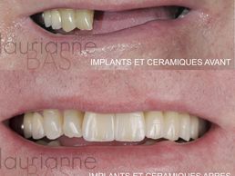 Bild zu Bas Laurianne