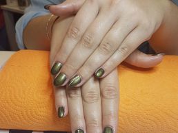 picture of Ami ongle