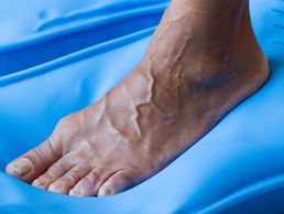 immagine di BT Podologie, Benjamin Travostino , podologue, Podologue du sport