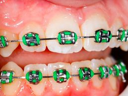 immagine di Tobler Fabienne