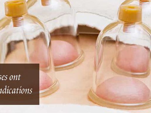 immagine di Massamaison