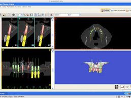immagine di Hacpille Pierre-Georges