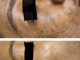 picture of Laser Beauté Morges